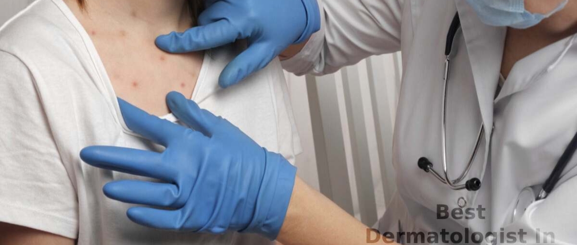 Best Dermatologist In Coimbatore
